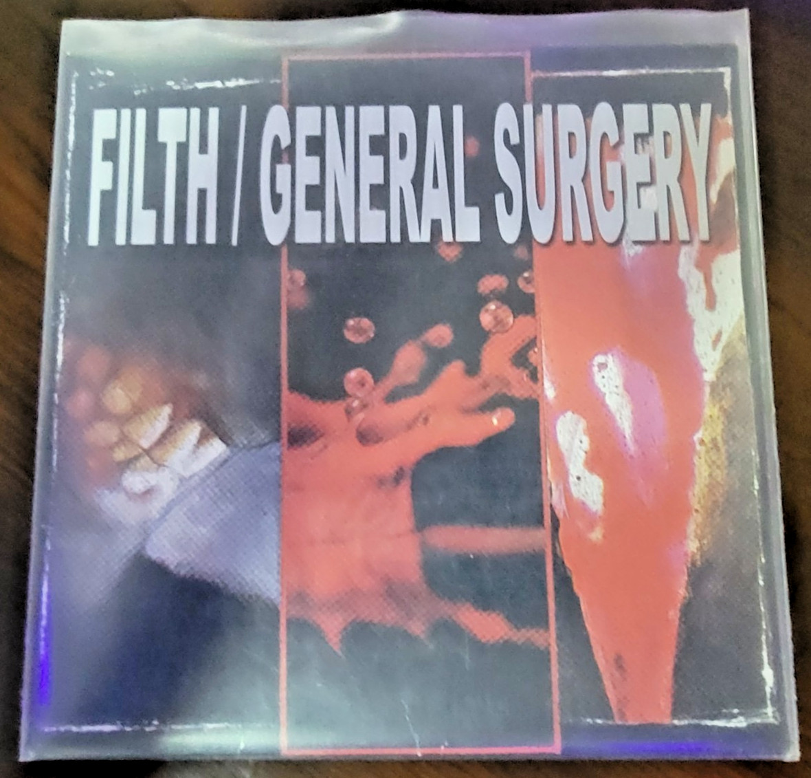 Filth / General Surgery split 7