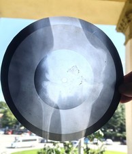 Rare Soviet X-Ray Bone RecordOriginal USSR Rib Disc – VintageMusic Artifact picture